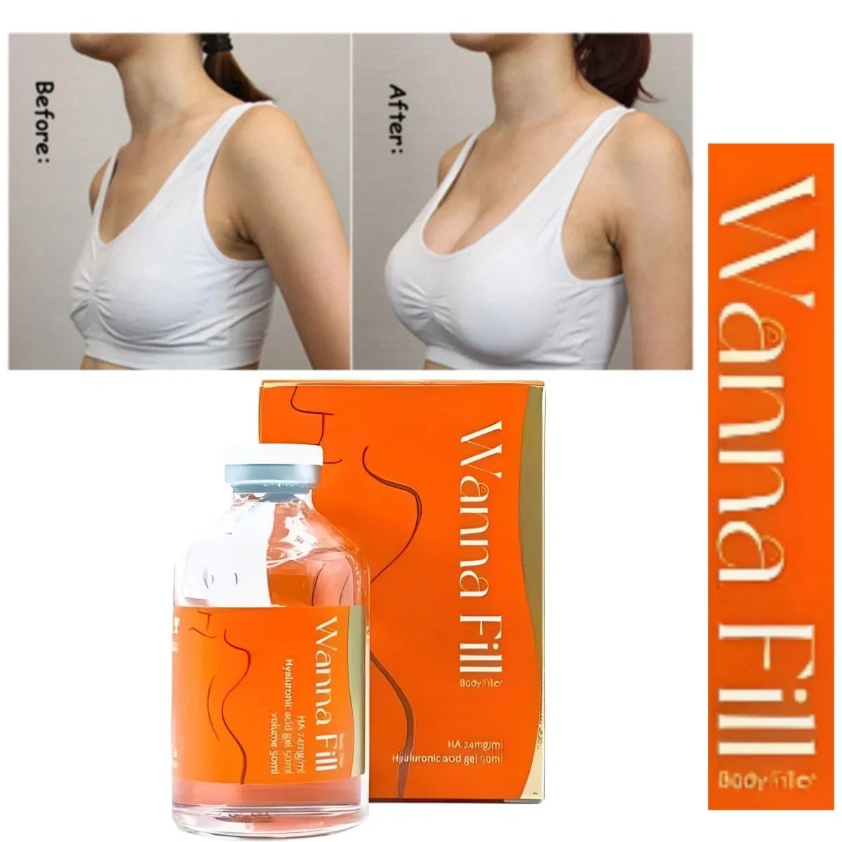 2024 Wanna Fill Maxy Fill Sedyfill – HA Dermal Filler for Breast, Buttock & Hip Enhancement