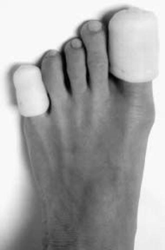 Toe Caps Pack of 3 – Cushioned Protection for Bunions, Blisters & Toe Pain