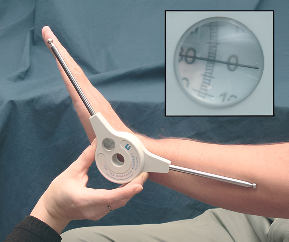 Extendable Goniometer – Precision Joint Range of Motion Tool