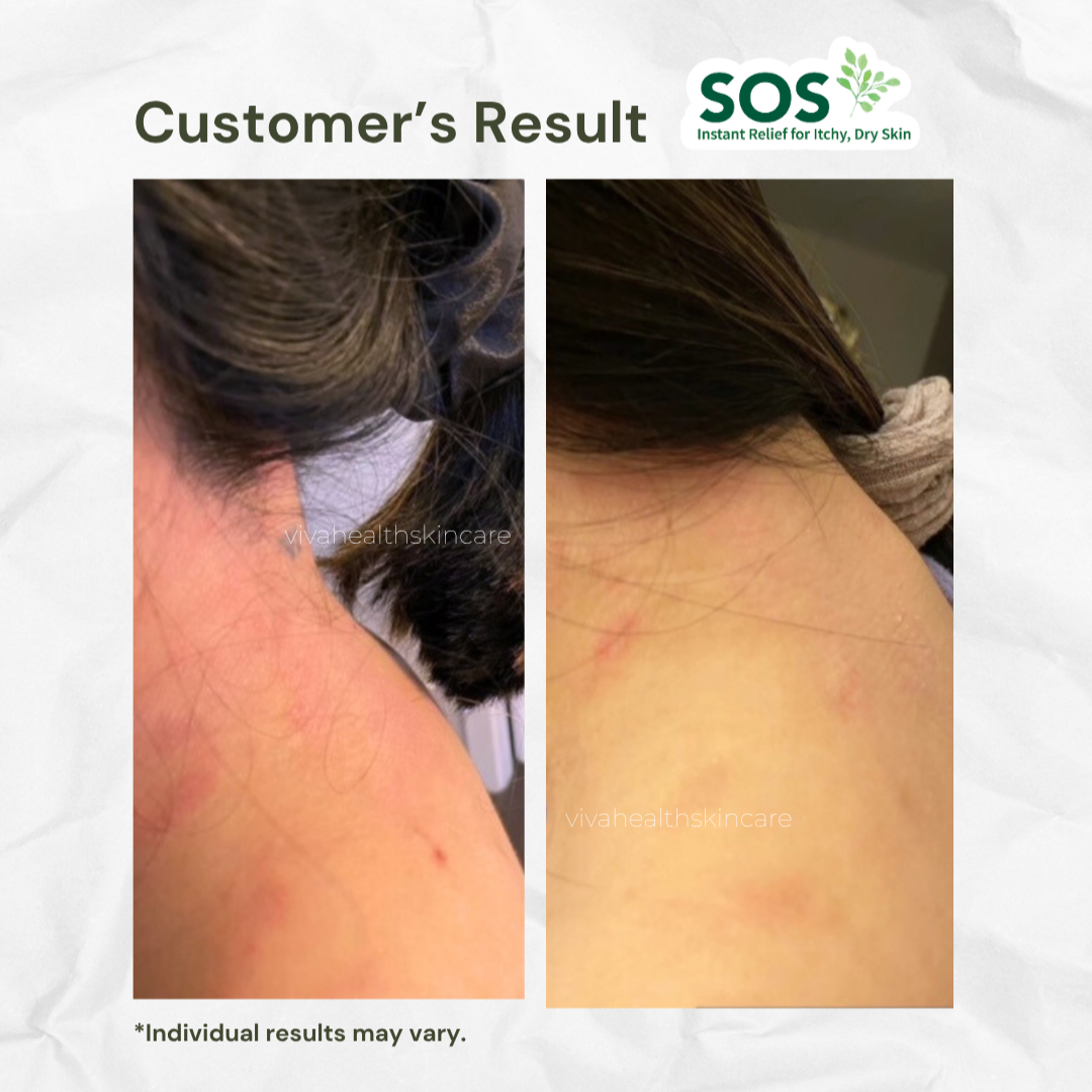 Zen Cream Soothing & Calming Skin Relief