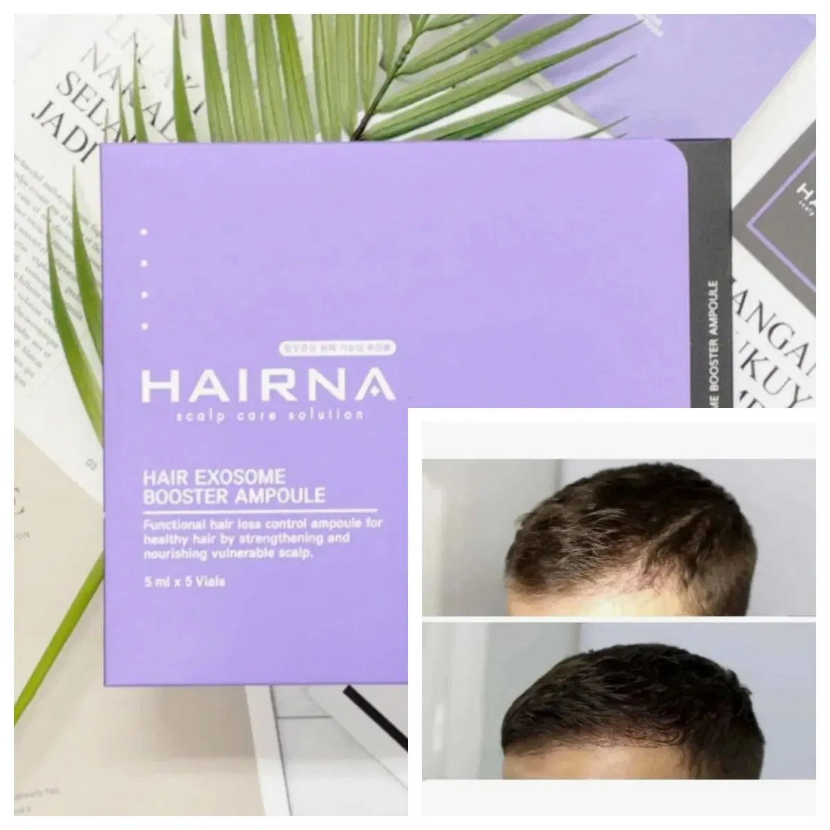 Hairna Hair Exosome Enhancer Ampoule – Hair Follicle Regeneration & Hair Growth