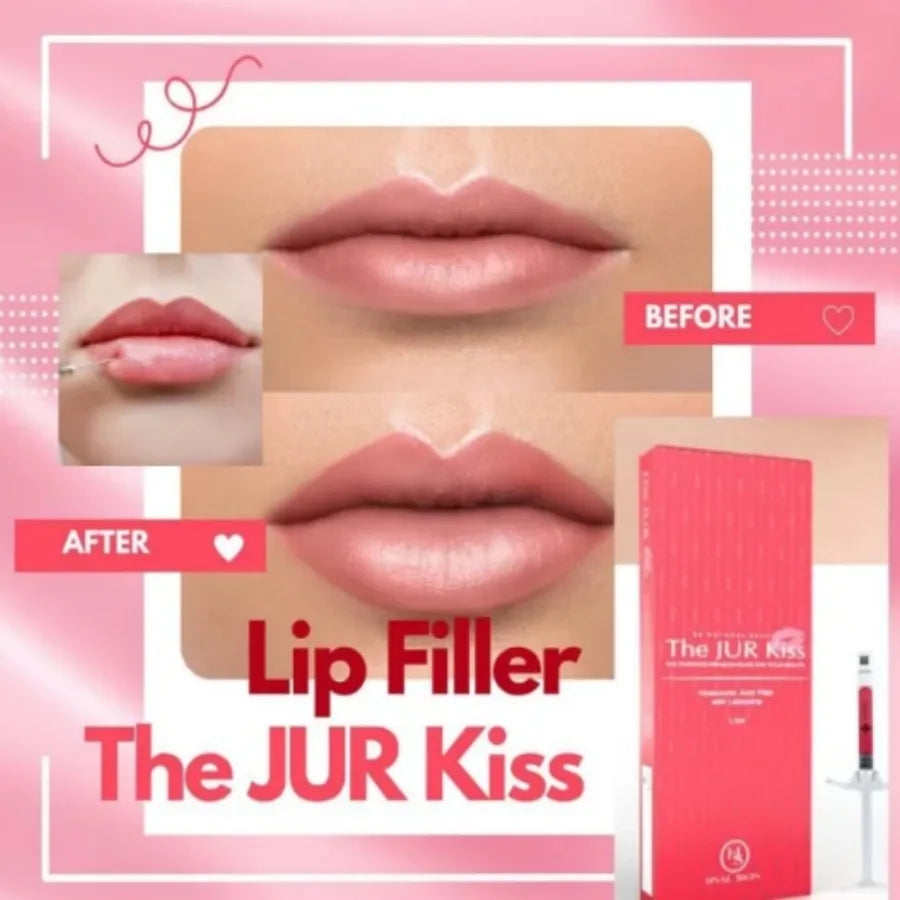 Jur Kiss Priere Lips Filler – Hyaluronic Acid Dermal Filler for Natural Lip Volume & Shape