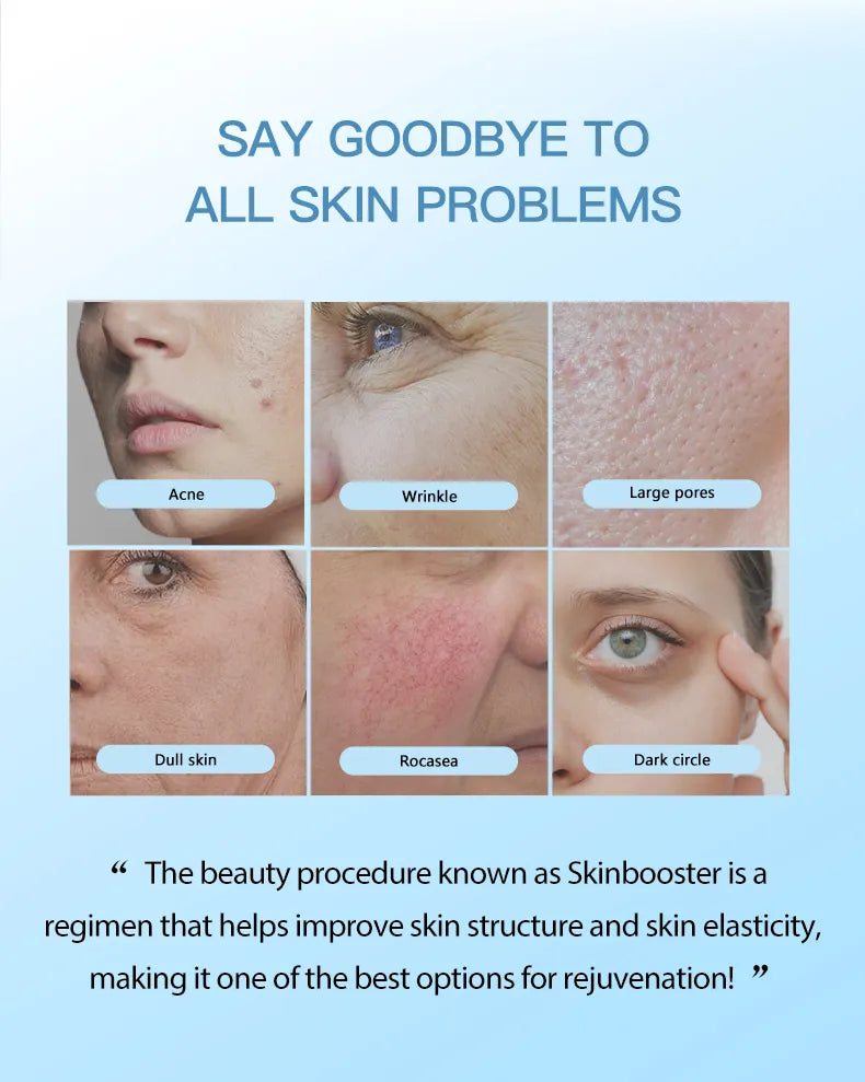 New 2 Vials Hyaluronic Acid Body Filler Injections Skin Booster – Deep Hydration & Body Contouring