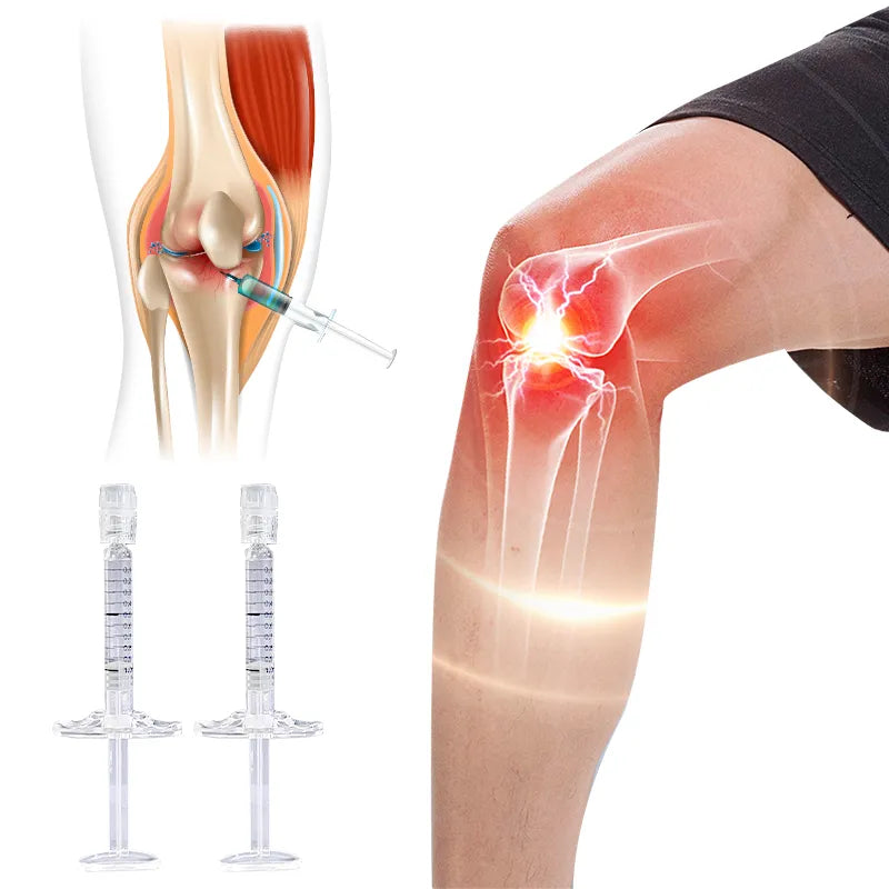 Medical Non-Cross Linked Hyaluronic Acid Filler – Knee Joint Injection for Pain Relief and Mobility