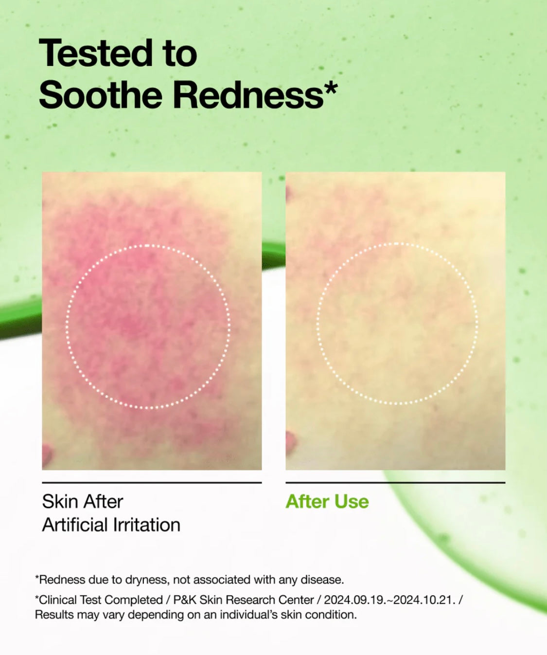 ANUA - Azelaic Acid 10 Hyaluron Redness Soothing Serum 30ml