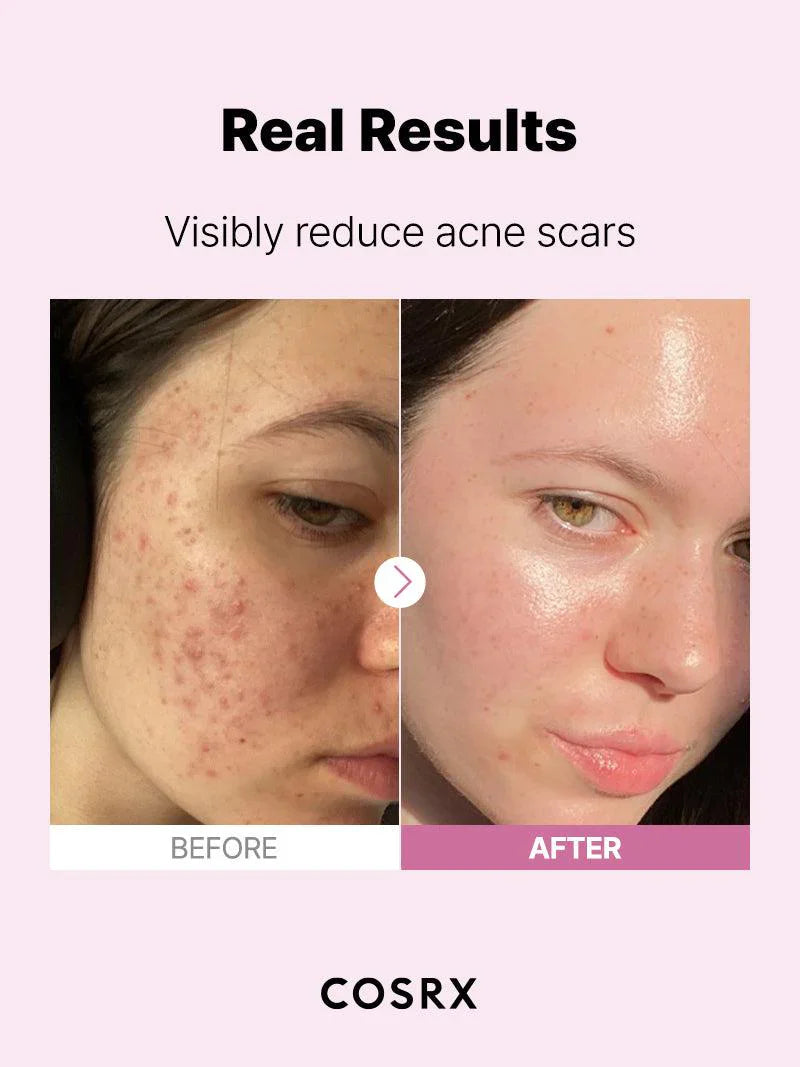 COSRX The Niacinamide 15 Serum – 20ml, Brightening & Pore Refining