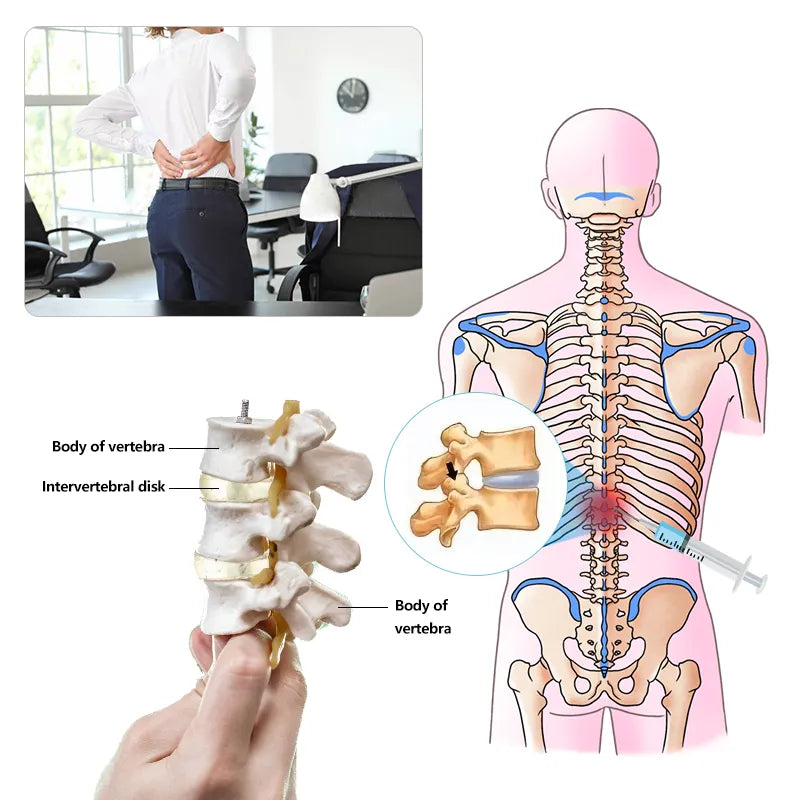 New No Animal Ingredients Hyaluronic Acid Filler Injection – Vegan-Friendly Skin Filler for Natural Volume & Hydration