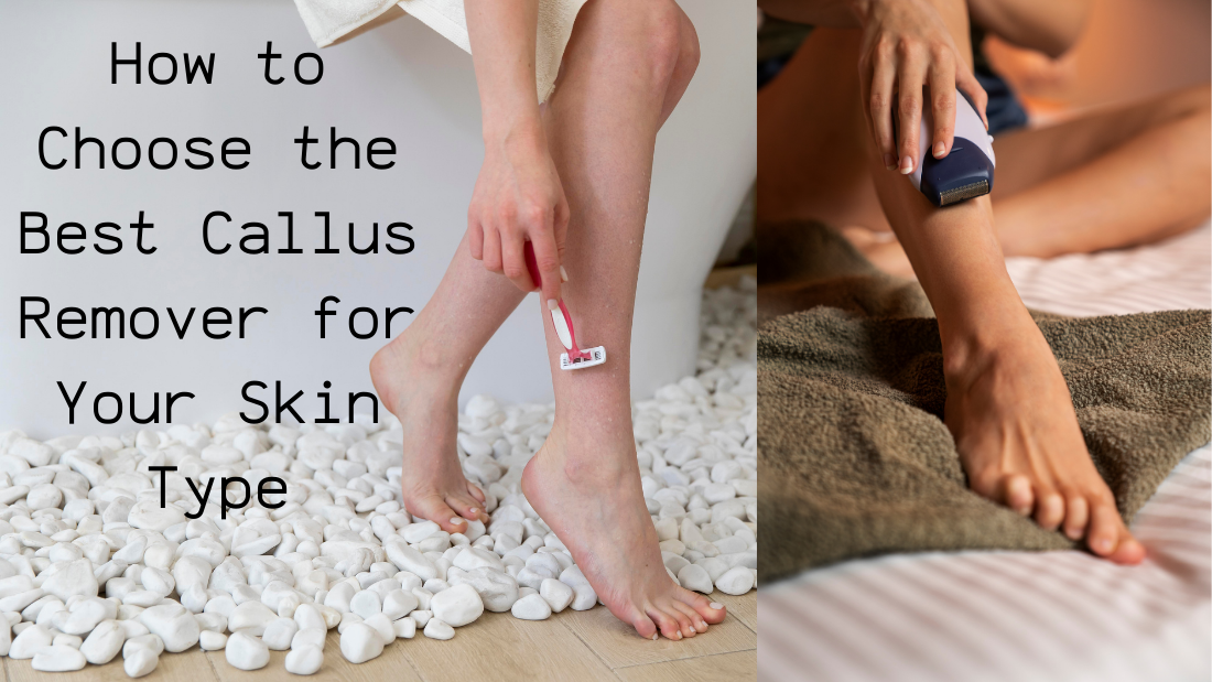 A person using a callus remover on their foot, with tips on choosing the best remover for different skin types on the left.