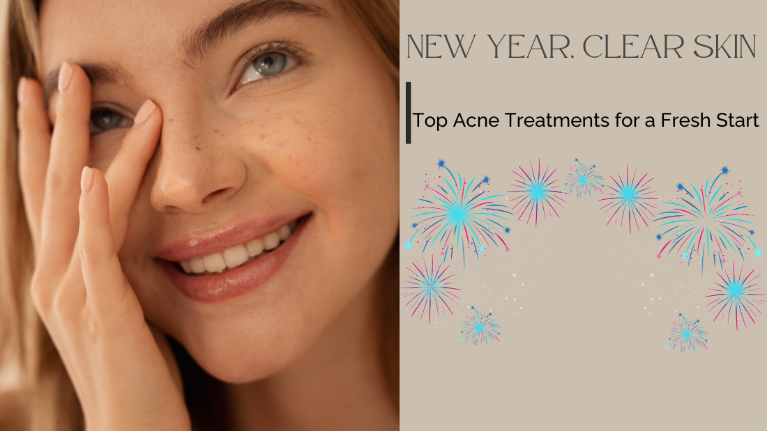 New Year, Clear Skin: Top Acne Treatments for a Fresh Start