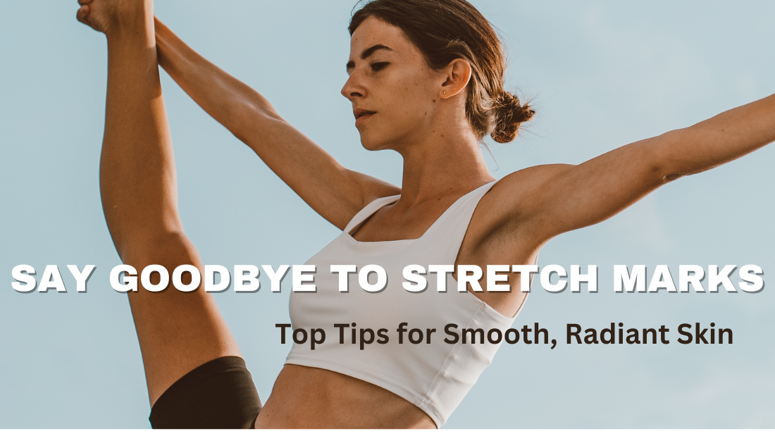 Say Goodbye to Stretch Marks: Top Tips for Smooth, Radiant Skin