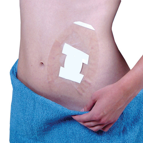 SEAL-TIGHT Shield (Pack of 5) – Waterproof Dressing & Wound Protector