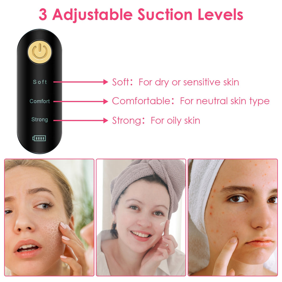 Blackhead Vacuum Remover Electric Acne Blackhead Comedone Extractor Remover Tool Facial Pore Cleaner Pimple Suction Tool