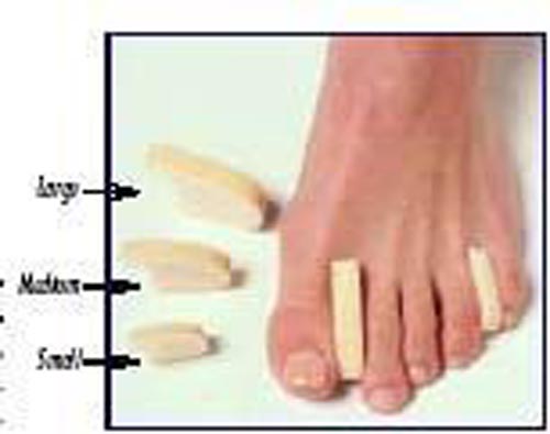 Toe Separator Box of 12 – Bunion, Hammertoe & Toe Alignment Relief