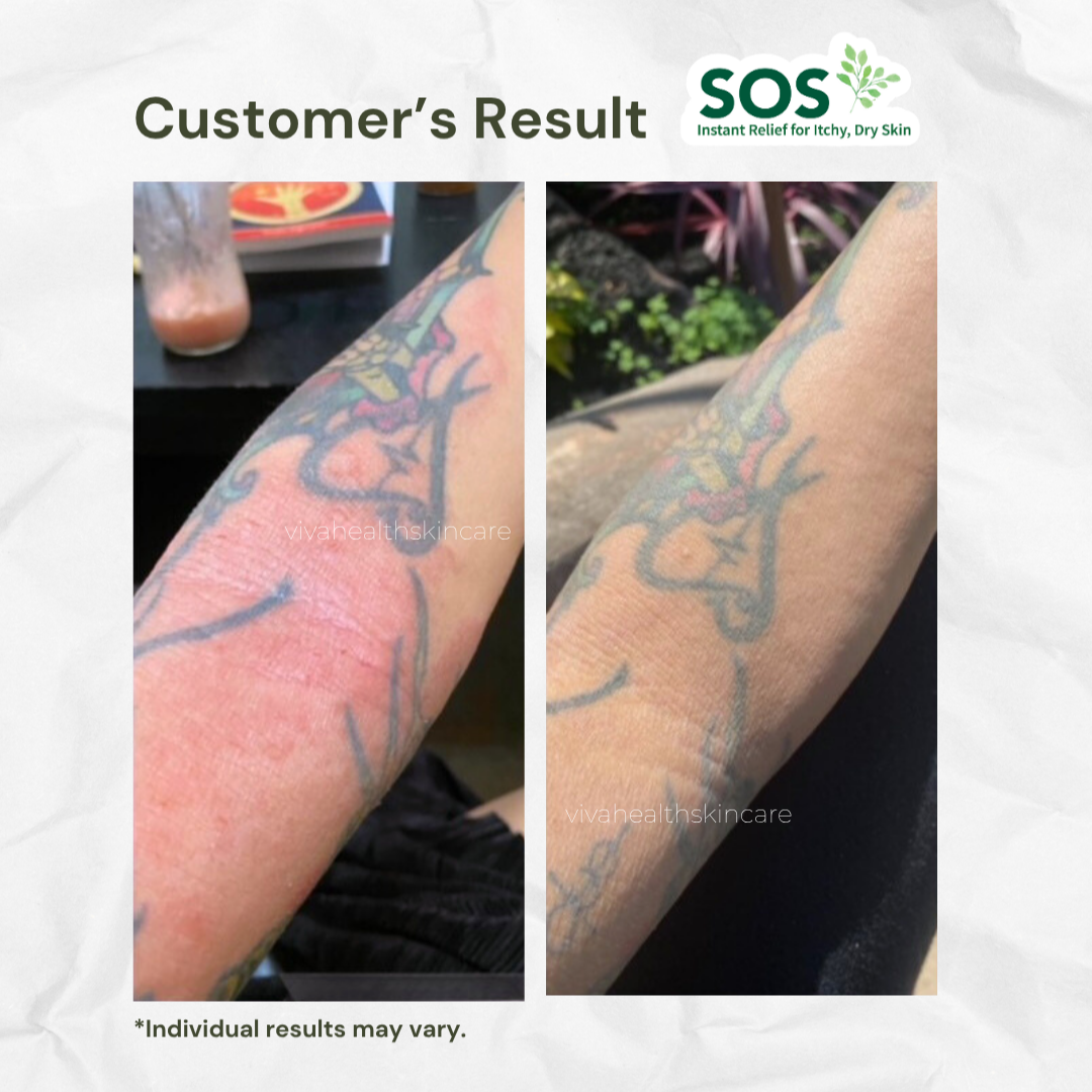 Zen Cream Soothing & Calming Skin Relief