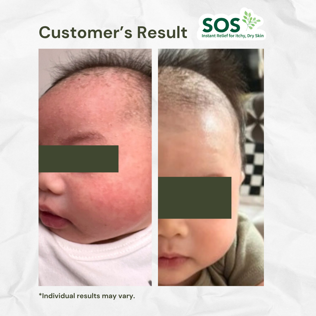 Zen Cream Soothing & Calming Skin Relief