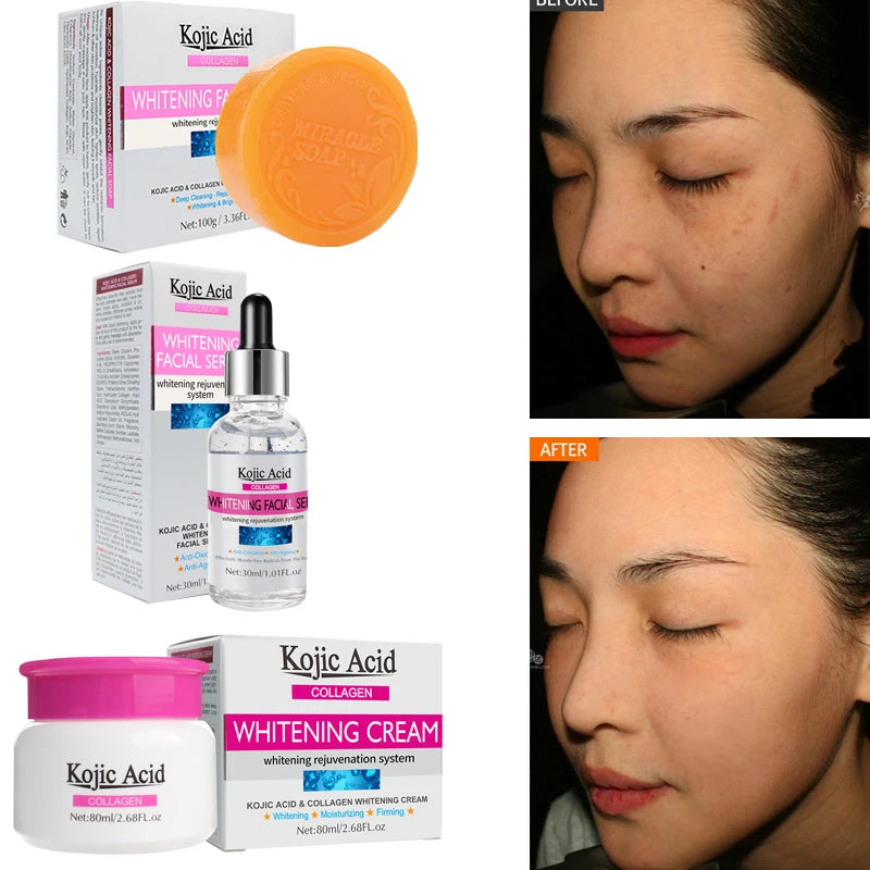 Kojic Acid Firming Face Cream+Facial Soap+Face Serum Lifting Neck Skin Care Set