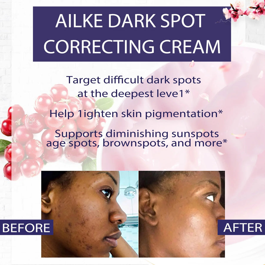 AILKE Dark Spots Remover Cream, For Armpit,Elbows, Legs, Age Spots,Sun Spots And Freckle Remover,With Glutathione &amp;Vitamin E