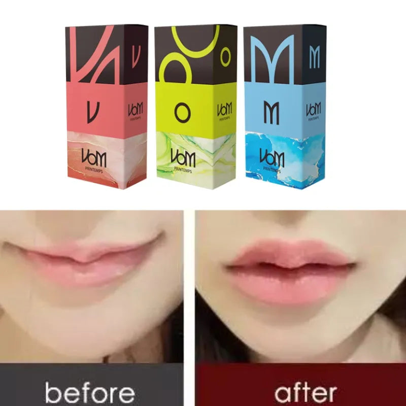 Bonetta Volume Cross-Linked Dermal Filler – Korea Vom 2ml Hyaluronic Acid for Lips, Nose & Facial Contouring