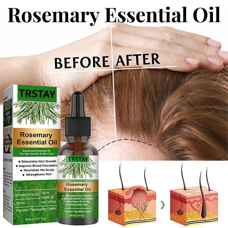 EELHOE Rosemary Essential Oil For Hair Growth 30ml