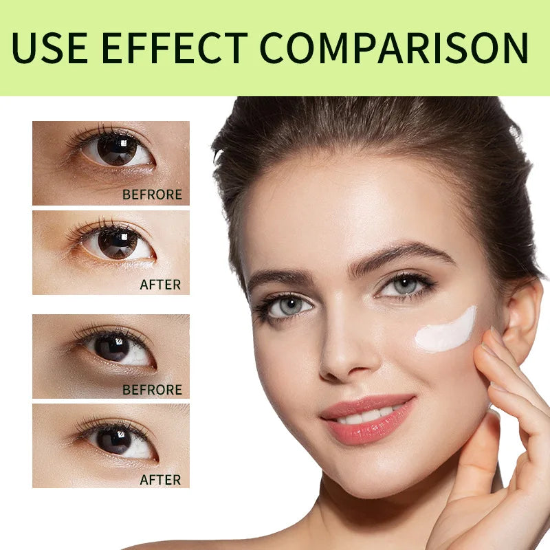 Anti-wrinkle  Anti Puffiness Remove Dark Circles Whitening Moisturizing Skin Care 6g