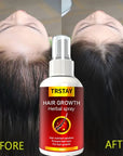 Hair Growth Fast Hair Growth  Anti Hair Loss Natural Beauty Health Hair Care