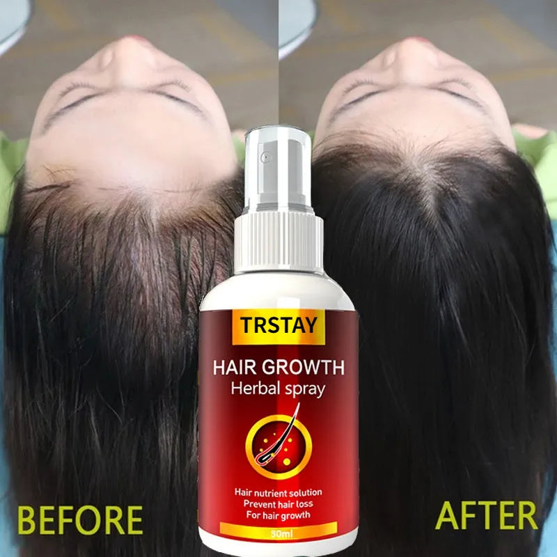 Hair Growth Fast Hair Growth  Anti Hair Loss Natural Beauty Health Hair Care