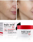 Kojic Acid Face Cream 7 Day Whitening Moisturizer Brighten Skin Remove Freckles 50g