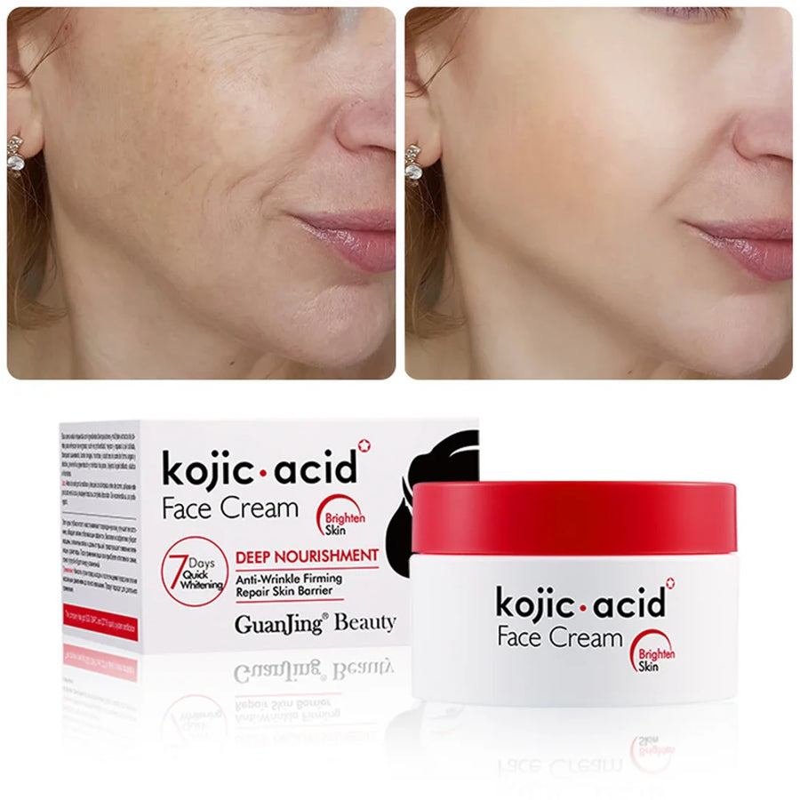 Kojic Acid Face Cream 7 Day Whitening Moisturizer Brighten Skin Remove Freckles 50g