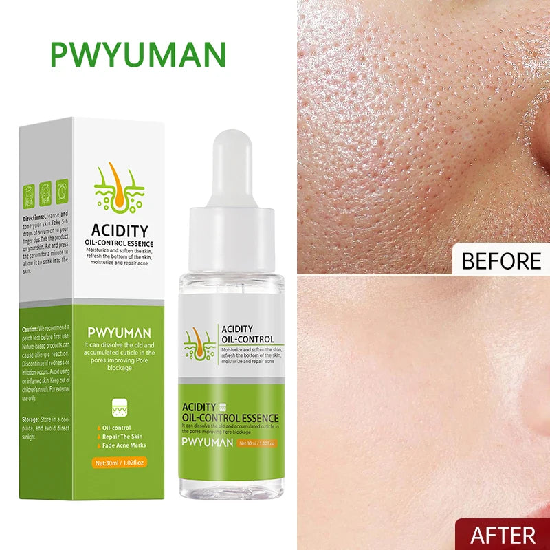 Pore Shrinking Serum Oil Control Pimple Acne Treatment Repair Soothe Skin Facial Moisturizer High Quality Korean Cosmetics 30ml