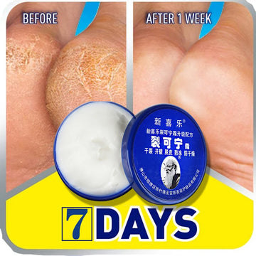 Traditional Chinese 33g Oil Anti-Drying Crack Foot Cream Heel Cracked Repair Cream Removal Dead Skin Hand Feet Care Foot Mask