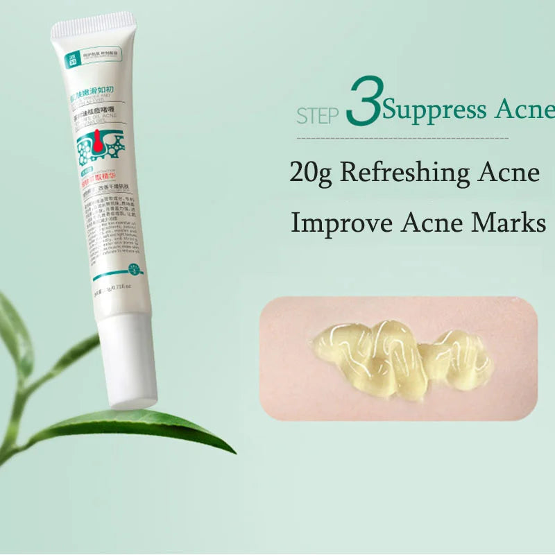 Herbal Acne Removal Face Cream Anti-Acne Mark Facial Care Set 100gm