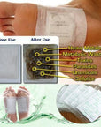 Korea Kinoki Foot Patch Deep Detox 100pcs=100pcs Patches+100pcs Adhesives Body Toxins Pad