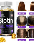 Hydrolyzed Collagen Capsules Collagen Supplement Care Biotin for Skin Joint Hair and Nail Care