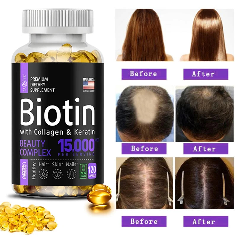 Hydrolyzed Collagen Capsules Collagen Supplement Care Biotin for Skin Joint Hair and Nail Care