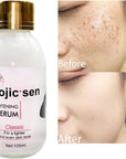 Kojic Sen Concentre With Collagen Serum Dark Spots More Radiant evum serum 125ml