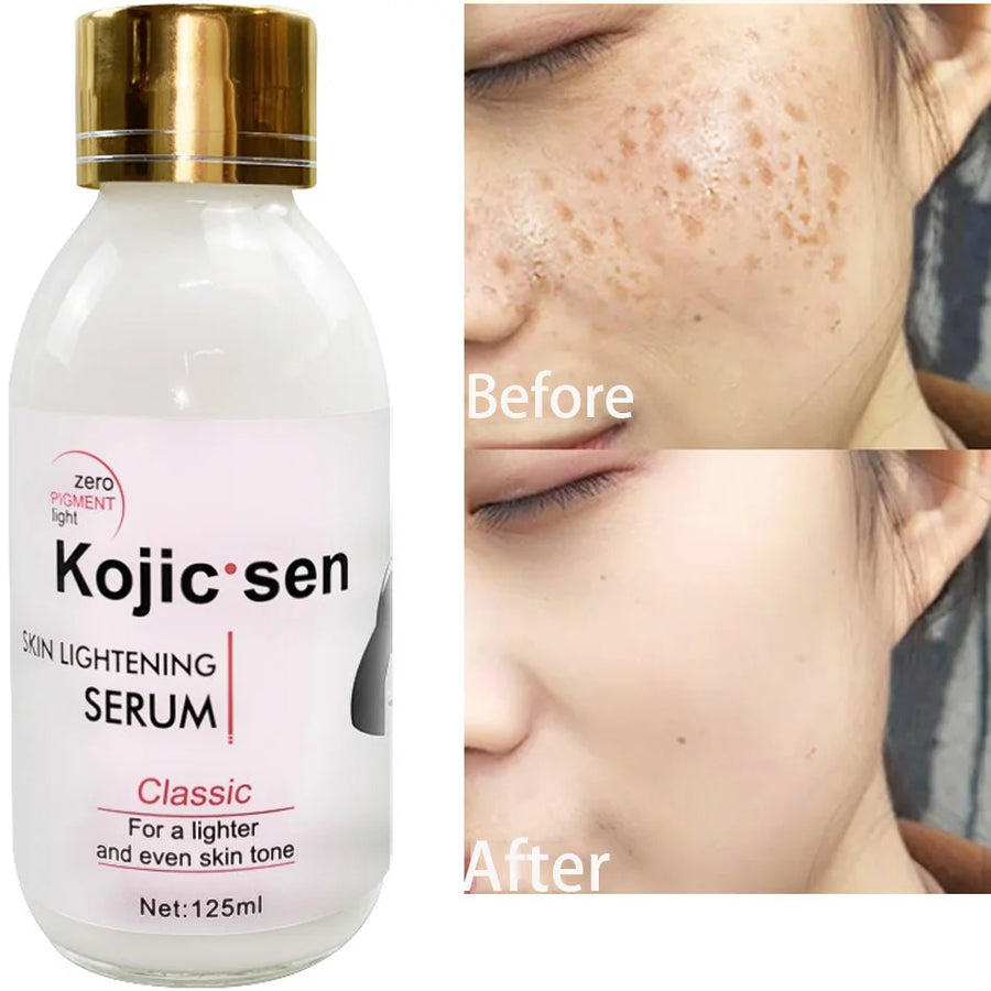 Kojic Sen Concentre With Collagen Serum Dark Spots More Radiant evum serum 125ml