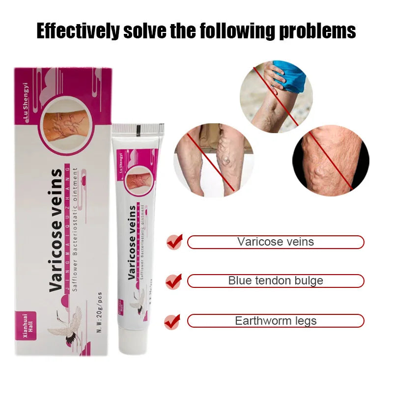 Varicose Vein Treat Cream Varicose Vein Vasculitis Ointment Relieves Spider Leg Vein Pain Phlebitis Medical Plaster Health Care