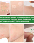 Flow Week Acne Pimple Patch Stickers 36 Dots 12mm