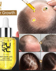 PURC Pure Anti Hair Loss And Hair Growth Serum