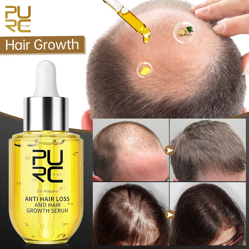 PURC Pure Anti Hair Loss And Hair Growth Serum