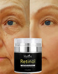 Mabox Retinol Face Cream Hyaluronic Acid AntiAging Remove Wrinkle Vitamin E Cream 50ml