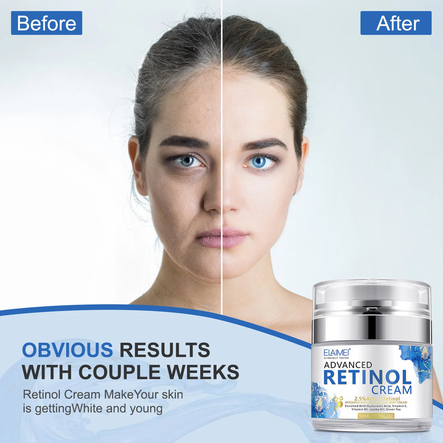 Retinol Face Cream Anti wrinkle Moisturizing Hyaluronic Acid Vitamin C Facial Cream Face Whitening Creams