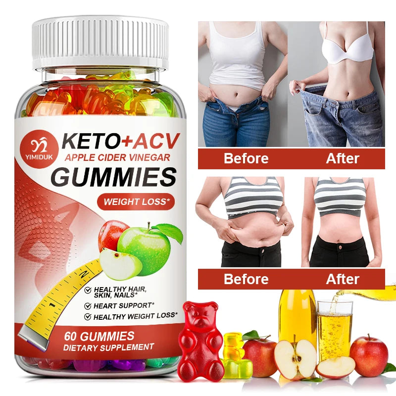 Keto Apple Cider Vinegar Gummies for Weight Loss and Burn Fat Slimming Belly Powerful Abdominal Fat Burning