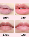 Lip Mask Sets Moisturizing Nourishing Brightening Anti Wrinkle Lips Masks Skin Care Products for Beauty