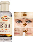 Vitamin E Face Serum Oil Anti-Wrinkle Spot Repai Dark 75ml