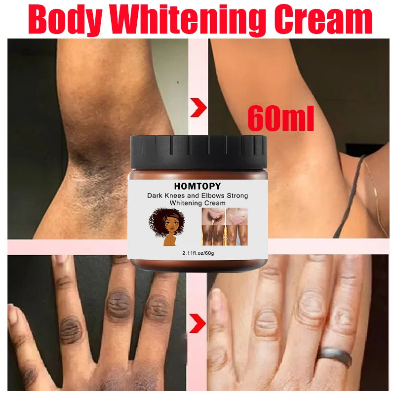 HOMTOPY Dark Knees And Elbowa Strong Whitening Cream 60g / 2.11 fl,oz