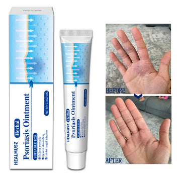 Psoriasis Cream Eczema Ointment Hand Tinea Psoriasis Treatment Foot Odor Versicolor Inhibit Dermatitis Fungus Anti-itch Cream