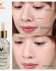 MeiYanQiong Gold Dynamisante Essence Anti Wrinkle