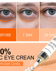 JoyPretty Vitamin C Brightening Eye Serum 20ml