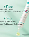 Herbal Acne Removal Face Cream Anti-Acne Mark Facial Care Set 100gm